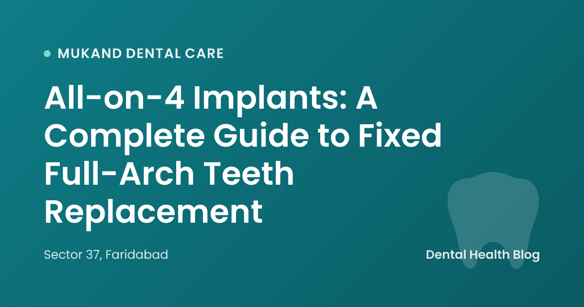 All-on-4 Implants: A Complete Guide to Fixed Full-Arch Teeth Replacement