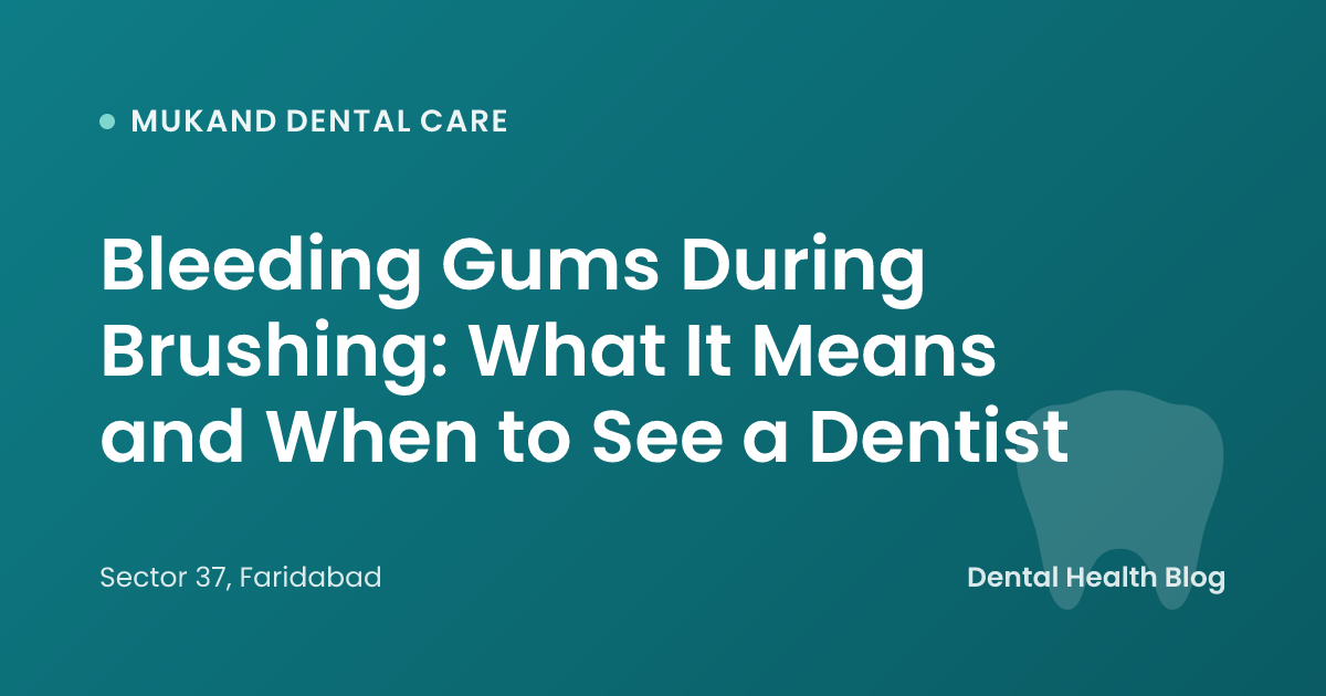 Bleeding Gums During Brushing: What It Means and When to See a Dentist