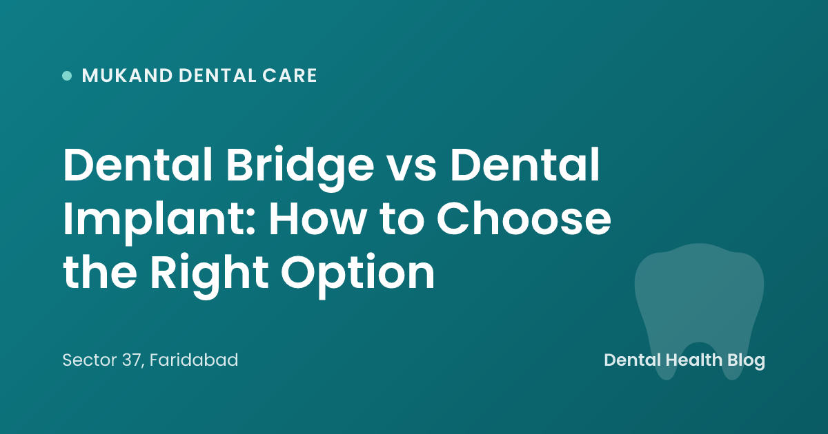 Dental Bridge vs Dental Implant: How to Choose the Right Option