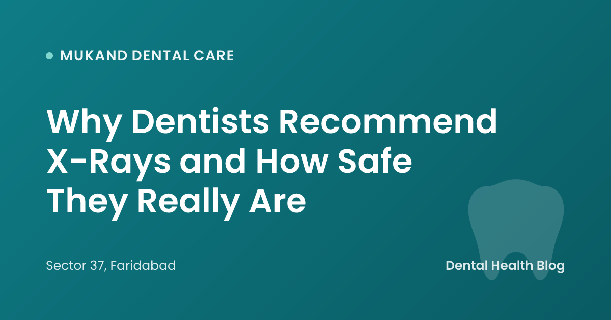 Why Dentists Recommend X-Rays and How Safe They Really Are