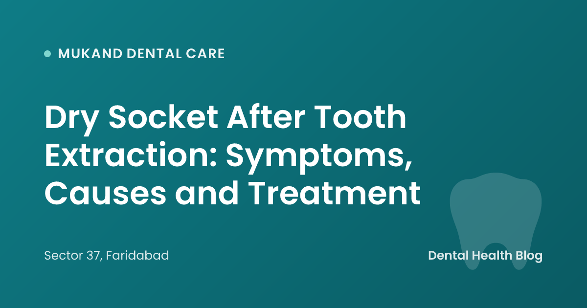Dry Socket After Tooth Extraction: Symptoms, Causes and Treatment