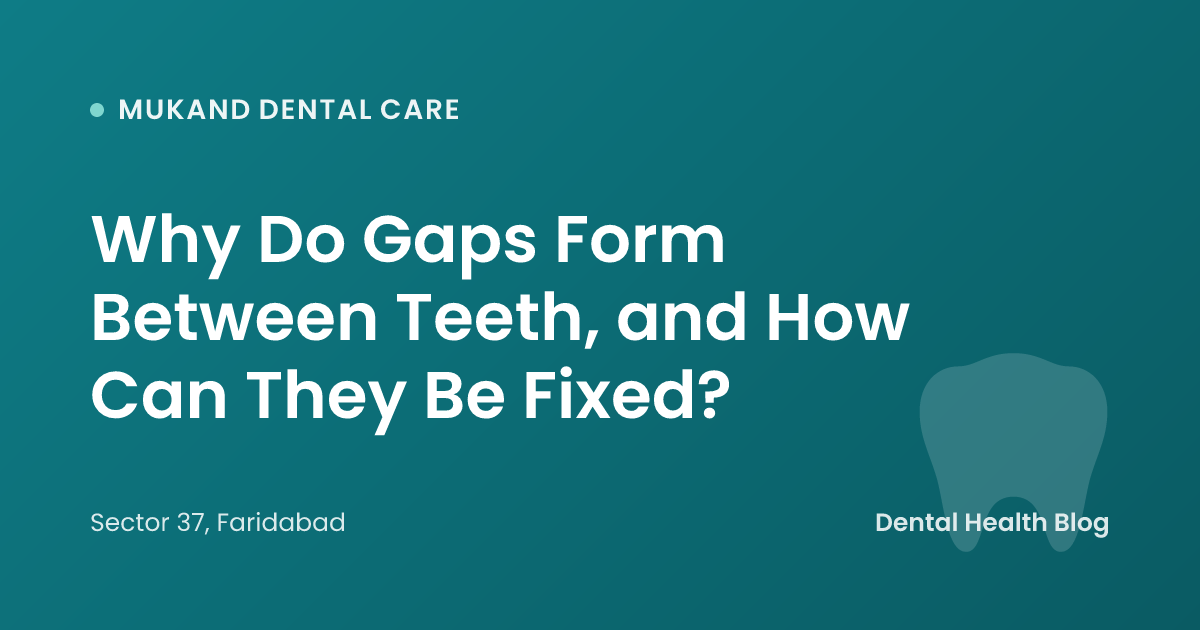 Why Do Gaps Form Between Teeth, and How Can They Be Fixed?