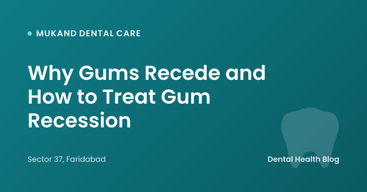 Why Gums Recede and How to Treat Gum Recession