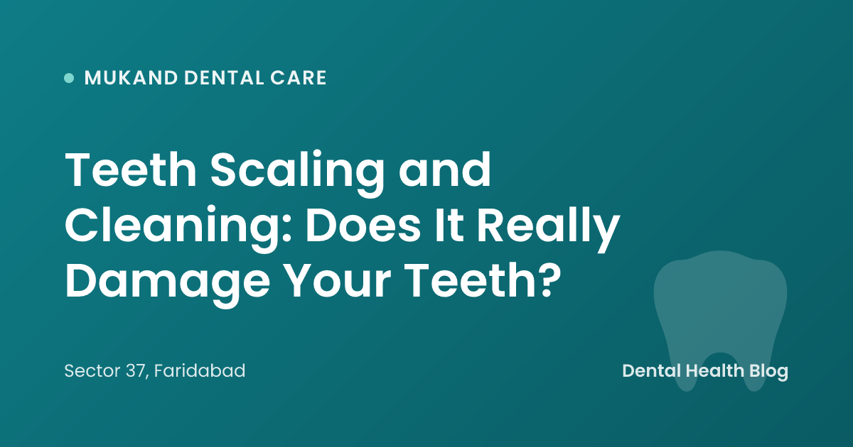 Teeth Scaling and Cleaning: Does It Really Damage Your Teeth?
