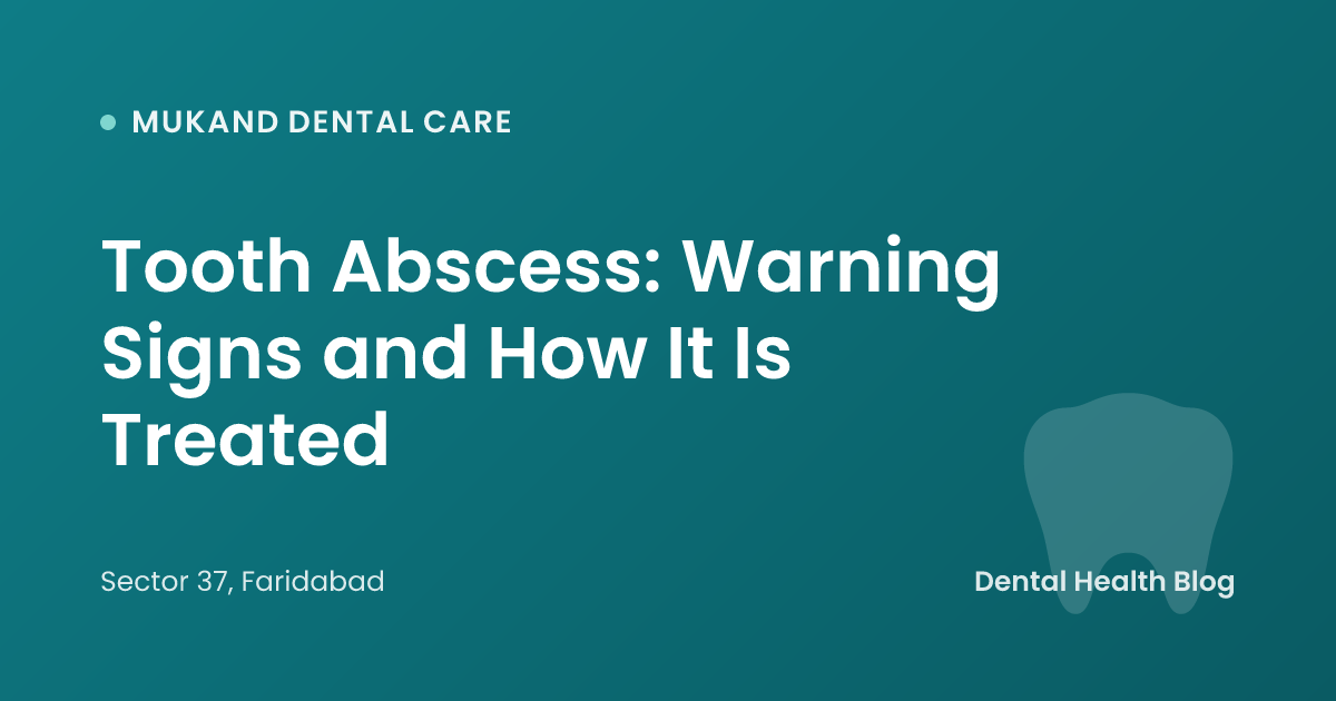 Tooth Abscess: Warning Signs and How It Is Treated