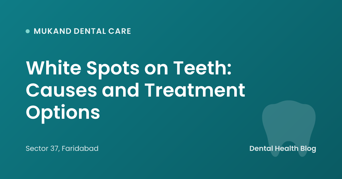 White Spots on Teeth: Causes and Treatment Options
